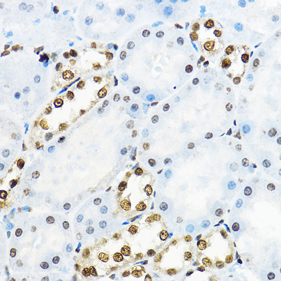 NR5A2 Rabbit polyclonal antibody