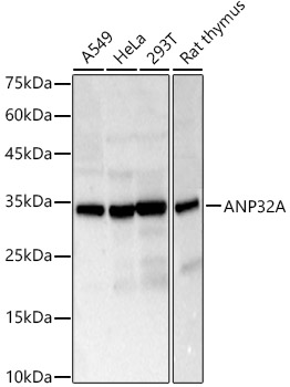 ANP32A Rabbit polyclonal antibody