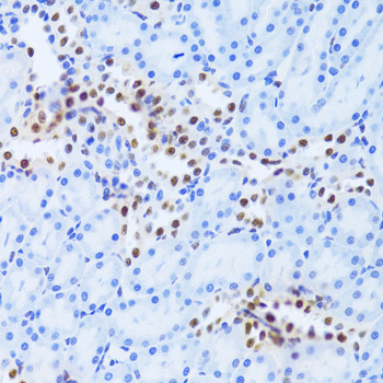 ANP32A Rabbit polyclonal antibody