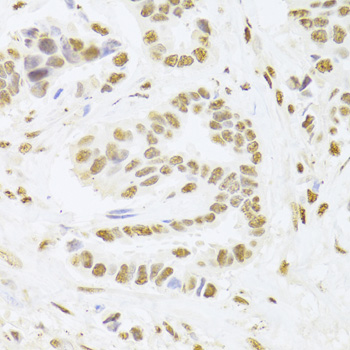 ANP32A Rabbit polyclonal antibody