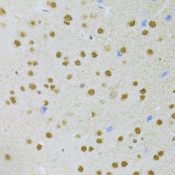 ANP32A Rabbit polyclonal antibody