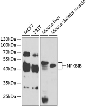 NFKBIB Rabbit polyclonal antibody