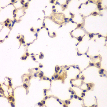 NFKBIB Rabbit polyclonal antibody