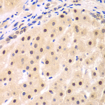 NFKBIB Rabbit polyclonal antibody