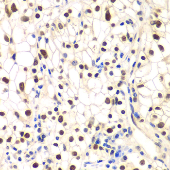 NFKBIB Rabbit polyclonal antibody