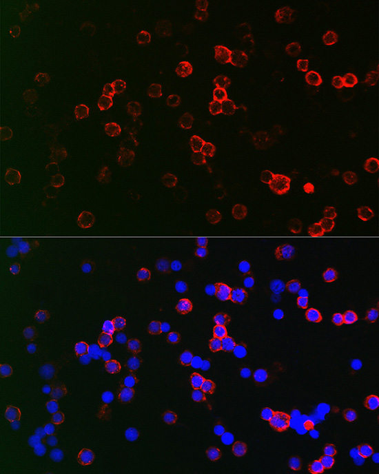 CD22 Rabbit polyclonal antibody