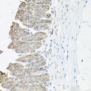 ATP1B1 Rabbit polyclonal antibody