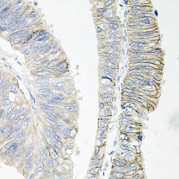 ATP1B1 Rabbit polyclonal antibody