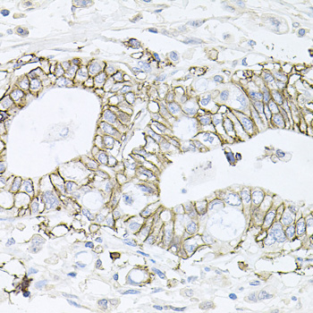ATP1B1 Rabbit polyclonal antibody