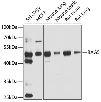 BAG5 Rabbit polyclonal antibody