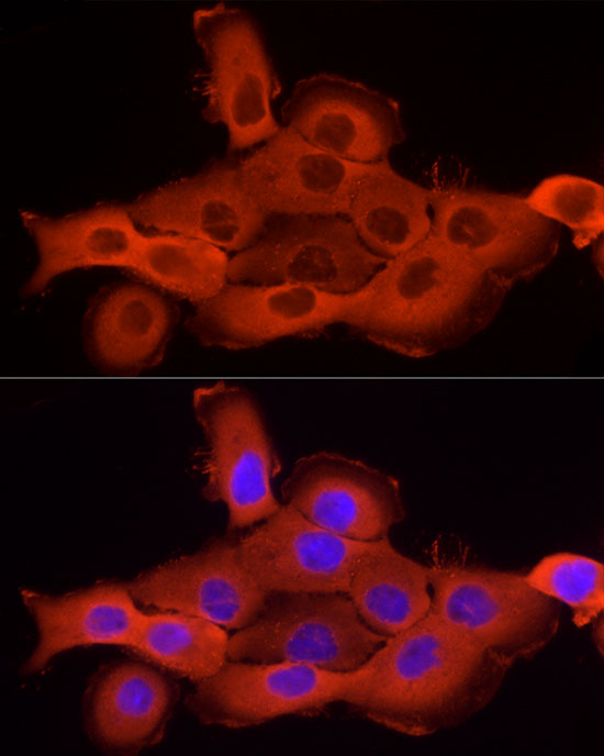 Cortactin Rabbit polyclonal antibody