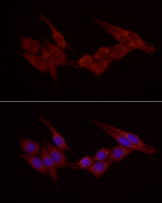 Cortactin Rabbit polyclonal antibody