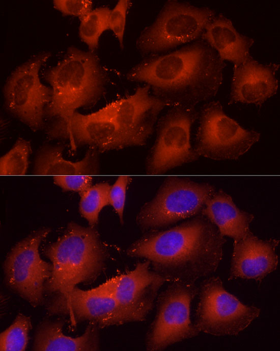Cortactin Rabbit polyclonal antibody