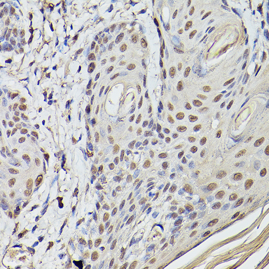 Pea3 / ETV4 Rabbit polyclonal antibody