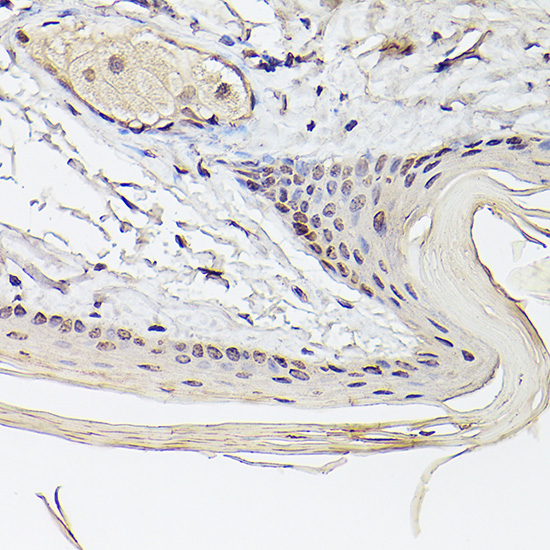 Pea3 / ETV4 Rabbit polyclonal antibody