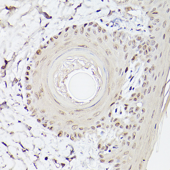 Pea3 / ETV4 Rabbit polyclonal antibody