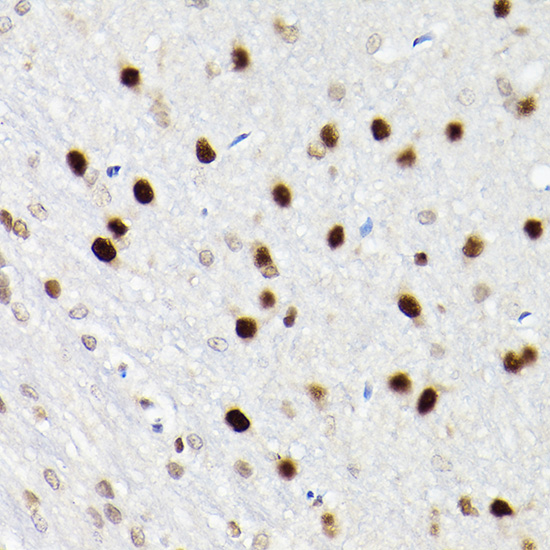 SATB1 Rabbit polyclonal antibody