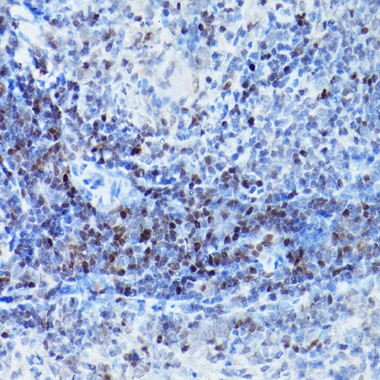 SATB1 Rabbit polyclonal antibody