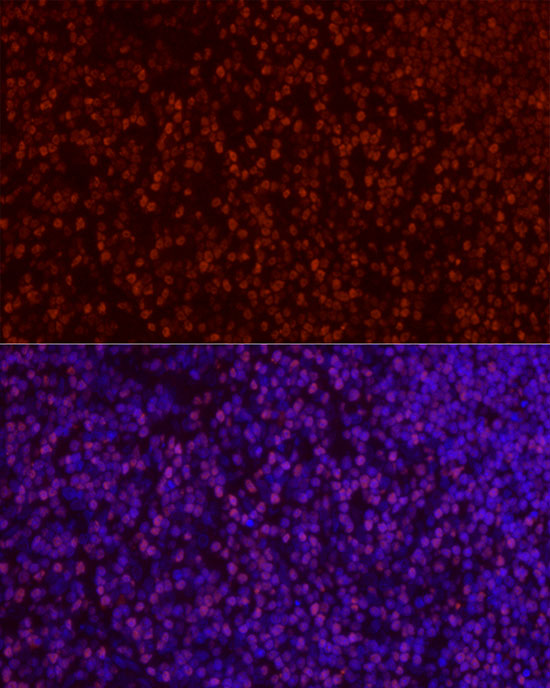 SATB1 Rabbit polyclonal antibody