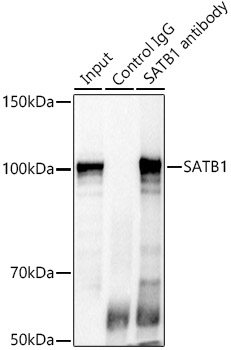 SATB1 Rabbit polyclonal antibody