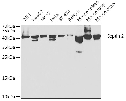 Septin 2 Rabbit polyclonal antibody