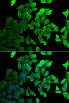 Septin 2 Rabbit polyclonal antibody
