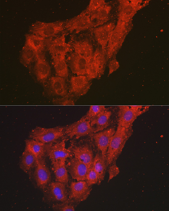 GRO alpha Rabbit polyclonal antibody