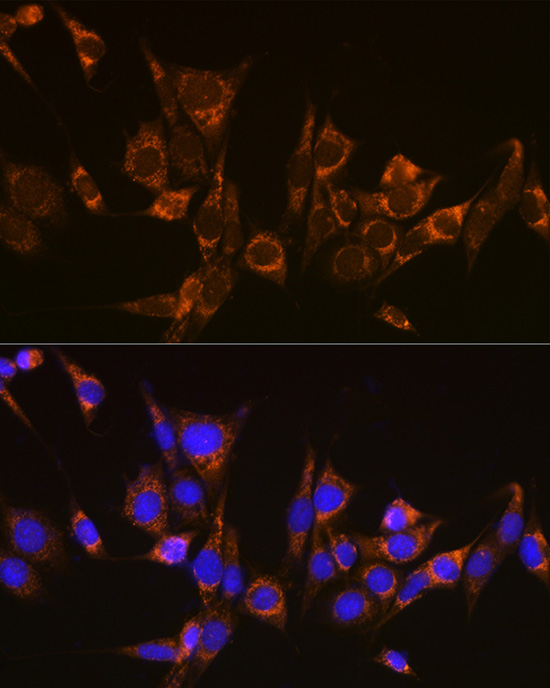 ATG3 Rabbit polyclonal antibody