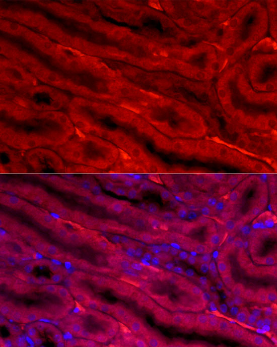 BBOX1 Rabbit polyclonal antibody