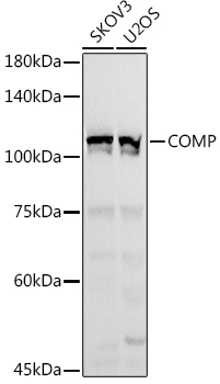 COMP Rabbit polyclonal antibody
