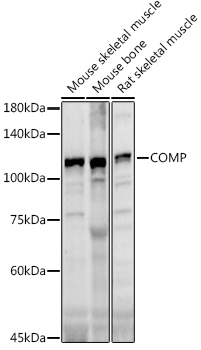 COMP Rabbit polyclonal antibody