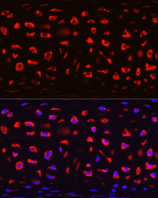COMP Rabbit polyclonal antibody