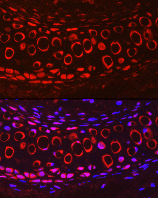 COMP Rabbit polyclonal antibody