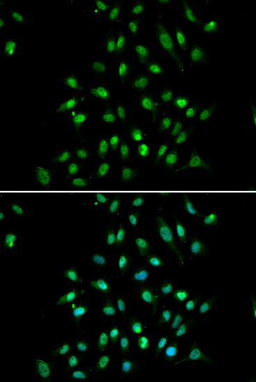 CXXC1 Rabbit polyclonal antibody