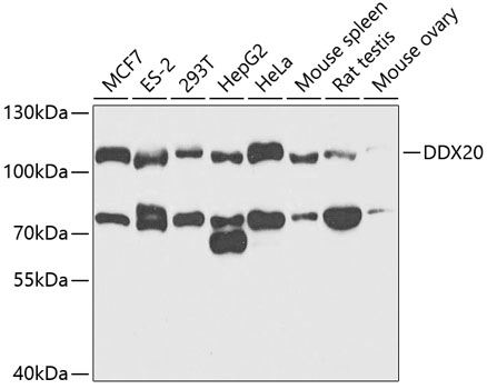 DDX20 Rabbit polyclonal antibody