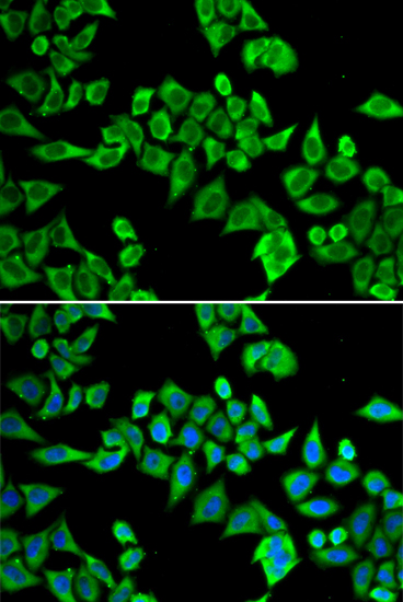 DDX20 Rabbit polyclonal antibody