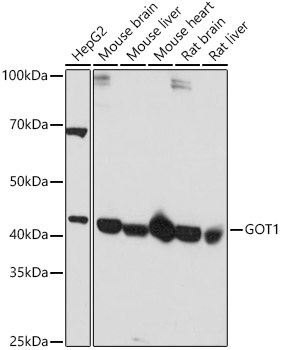 GOT1 Rabbit polyclonal antibody