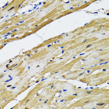 GOT1 Rabbit polyclonal antibody