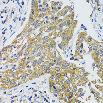 GOT1 Rabbit polyclonal antibody