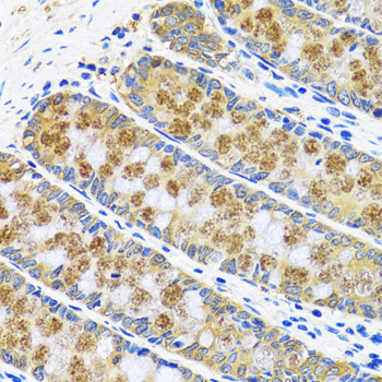 GOT1 Rabbit polyclonal antibody