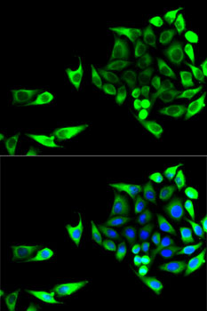 GOT1 Rabbit polyclonal antibody