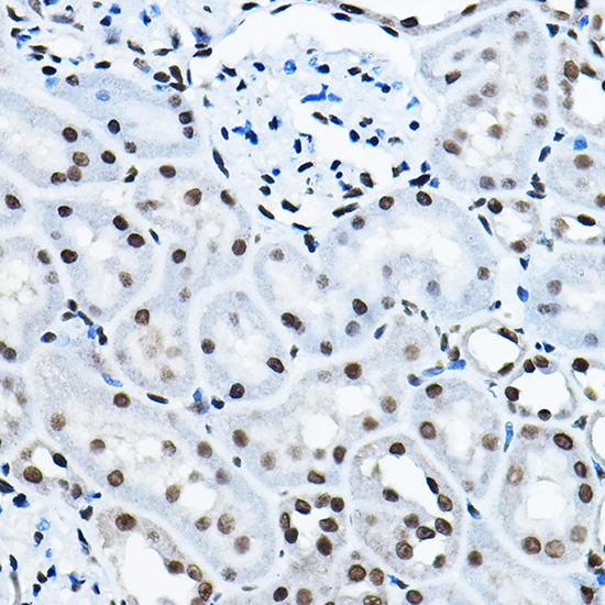 KAT7 Rabbit polyclonal antibody