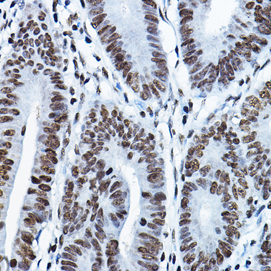KAT7 Rabbit polyclonal antibody
