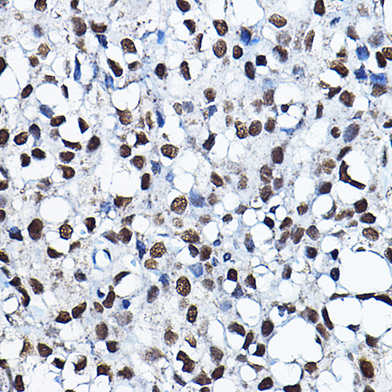 KAT7 Rabbit polyclonal antibody