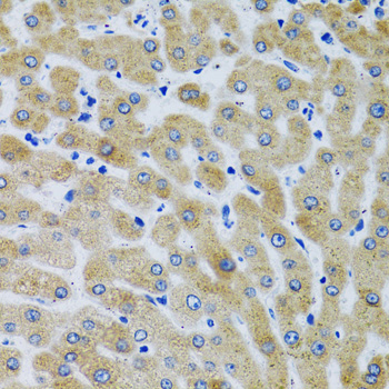 MBL2 Rabbit polyclonal antibody