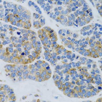 MBL2 Rabbit polyclonal antibody