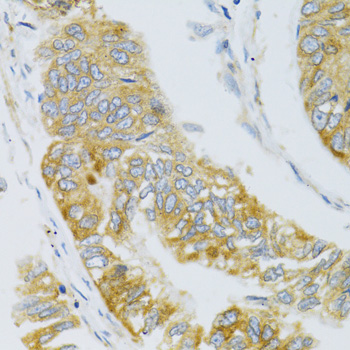 MBL2 Rabbit polyclonal antibody