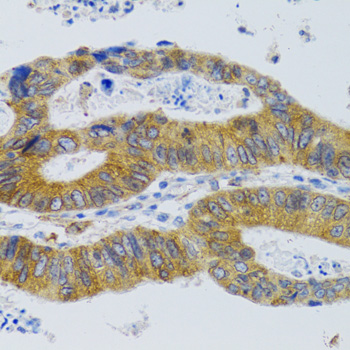 MBL2 Rabbit polyclonal antibody