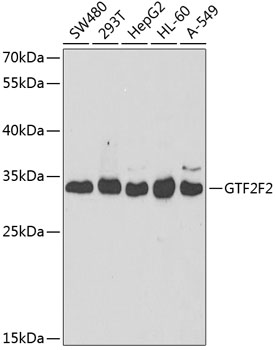 GTF2F2 Rabbit polyclonal antibody