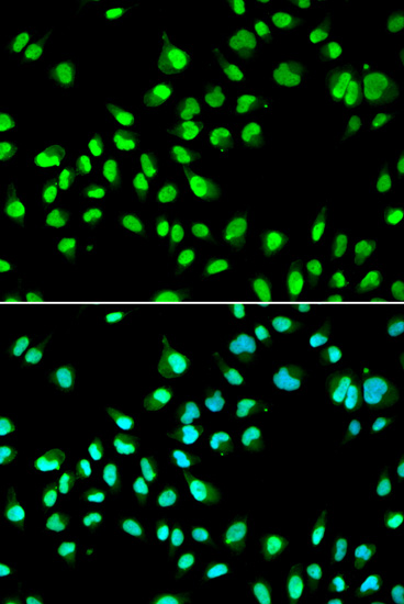 GTF2F2 Rabbit polyclonal antibody